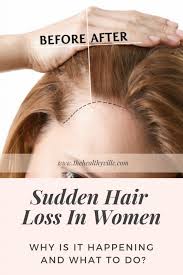 Early signs of hair loss new moms: Sudden Hair Loss In Women Why Is It Happening And What To Do Sudden Hair Loss Anti Hair Loss Hair Loss Women