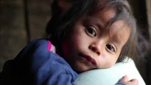 "Seeds of Tomorrow" Project: Changing the Cycle of Child Hunger in Tactic,  Guatemala