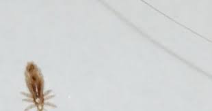 Head Lice Pictures Head Louse Close Up Picture Lice Pictures Head Louse Head Lice Pictures