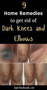 Check spelling or type a new query. 9 Proven Ways To Get Rid Of Dark Elbows And Knees Dark Elbows Dark Spots On Skin Skin Lightening Diy