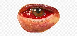 Share your favorite gif stickers now. Eye Bloodshot Blood Redeye Red Bloodshot Eyes Png Emoji Bloodshot Eyes Emoji Free Transparent Emoji Emojipng Com