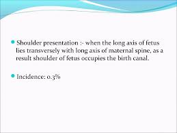 Image result for Shoulder Presentation