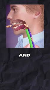 Trachea Removal After 7 Weems