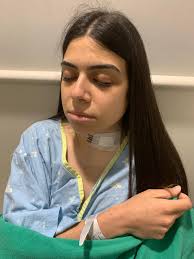 Burning Limb Foundation