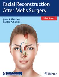 Facial Reconstruction After Mohs Surgery Ebook Mohs Surgery Surgery Facial Plastic Surgery