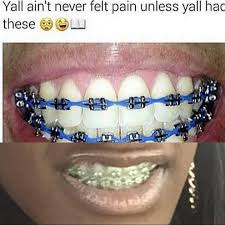 Maybe you would like to learn more about one of these? You Broke Your Arm Thats Not Painful Gatekeeping