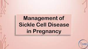 Anemia is a relatively normal finding in pregnancy. Rcog Guideline Management Of Sickle Cell Disease Youtube