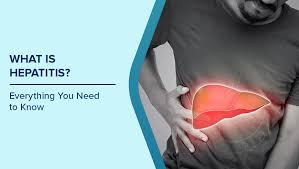 Image result for hepatitis symptoms