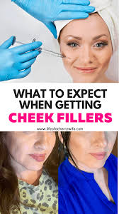 Definitive guide on cheek augmentation with fillers, including the procedure overview, benefits, risks, recovery, before & after photos, costs, and more. What To Expect When Getting Cheek Fillers Life Of A Cherry Wife