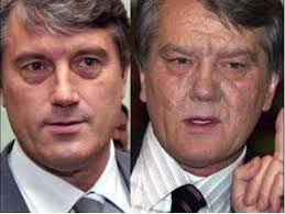 .a hallmark of dioxin poisoning. Kiselyov S Disinformation Yushchenko Was Poisoned By Cosmetic Procedures Drupal