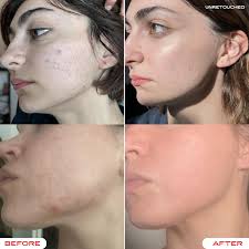 Tallow & Tansy Face Balm, 2oz