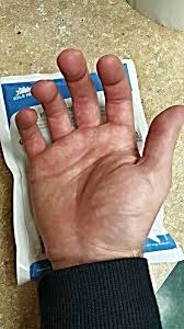 Pin On Crps