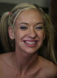 Motherless Braces: All You Need to Feed Your Fetish
