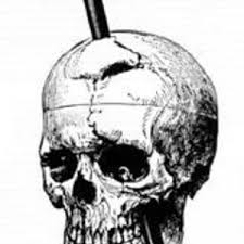 Fiction ever since, and he eventually published a scholarly book about. Listenwise Learning About Brain Science From Phineas Gage