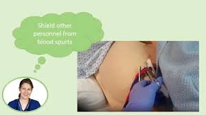 Image result for Active Management of Labor