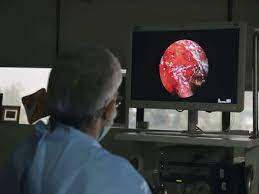 Check spelling or type a new query. Yellow Fungus Infection After Black And White Fungus Yellow Fungus Reports From Ghaziabad The Economic Times Video Et Now