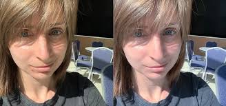 How To Fix Blemishes In Photoshop Express To Get Flawless Skin In Your Selfies Smartphones Gadget Hacks