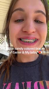 Cotton Candy Braces Colors