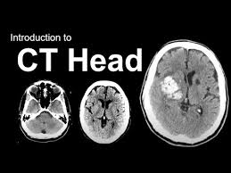 Image result for CT Head