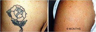 Wrecking balm tattoo fade system www.wreckingbalm.com Tattoo Removal Cream Natural Fading System Wrecking Balm 2 Week Sparta Ninthavenue United Arab Emirates