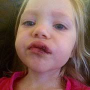 BLAKE MEDICAL CENTER