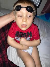 Helmet experiences for brain trauma and stroke treatment?