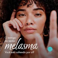 Eu sei, eu sei, o Melasma no verão é um GRANDE desafio, mas antes de falar  que não é possível mantê-lo sobre controle nos períodos mais quentes, passe  para o lado e