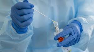 A peer review of the paper on which most covid testing is based has comprehensively debunked the science behind it, finding major flaws. Covid 19 Corona Test So Viel Kostet Er Kommt Bald Der Schnelltest Fur Zuhause Gesundheit