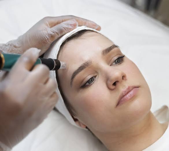 Best Microneedling Treatment Clinics in Dubai &ndash; Mankhool
