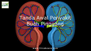 Khasiat air daun sup daun sup in english kegunaan daun sup. Khasiat Daun Sup Untuk Ginjal Cuci Buah Pinggang Cara Tradisional By Buana Studio