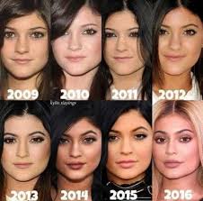 Tinseltown and eugene powers / shutterstock, getty images. Botox Santa Barbara Best Botox Injections Wrinkle Treatments Kylie Jenner Body Kendall And Kylie Jenner Kylie Jenner
