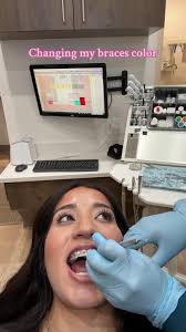 Amparadise Braces Girl