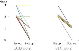 Anterior drawer test is performed to test the integrity of the anterior cruciate ligament of the knee. Clinical Results Of The Posterior Drawer Test In Pre And Postoperative Download Scientific Diagram