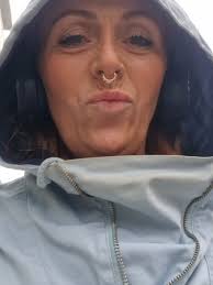 So many messages to show you all my huge swollen lips😂 Thank you to  @eden.fox.aesthetics for having me in