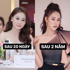 Cách chữa ung thư dạ dày bằng thuốc đông y cổ truyền. PhÆ°Æ¡ng Oanh Cong Khai áº£nh TrÆ°á»›c Va Sau Khi Pháº«u Thuáº­t Baohaiduong