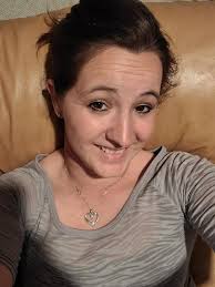 Good Afternoon… A few months back my dermatologist removed a skin lesion  from my face and sent it to be biopsied at the lab. She was worried about  its appearance, and considering