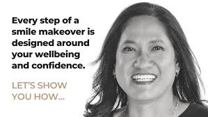 Digital Smile Design in Houston, TX