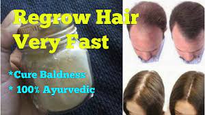 Click here for more tips and tricks information: Ayurvedic Medicine For Hair Growth On Bald Head In Hindi