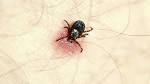 How to Get Ticks off Dogs (with Pictures) - How