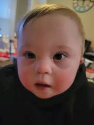 Charlie's Champs Team Walk Event for Down Syndrome Awareness