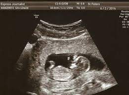 The image helps your doctor know how your baby is doing—and gives you a peek at your baby as well. 55 Top Photos Fake Pregnancy Ultrasound App Ultrasound Spoof Fake Free Apps 148apps Asiahkamal