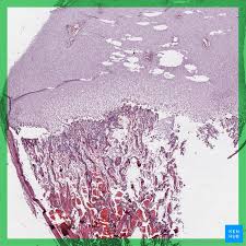Polished serial cross sections and epiphyseal longitudinal sections of nothosaurus mirabilis long bones in comparison. Bone Formation Histology And Process Of The Ossification Kenhub
