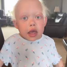 TikToker Bella Brave, 10, Placed in a Medically Induced Coma