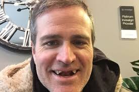 Fundraiser for Chris White by David Angus : Fix Chris' Broken Smile