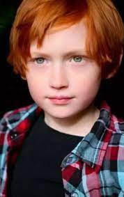 The gene for red hair also causes an increased sensitivity to sunlight and a reduced sensitivity to anesthesia. Why Is It More Common For Redheads To Have Green Eyes Than Blue Ones Quora
