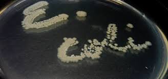 Coli), a blockages in the urinary tract. Starve E Coli Of Copper To Cure Aggressive Utis Invisiverse Wonderhowto