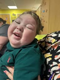 Theo Enjoys Pizza Despite Feeding Tube and Tracheostomy