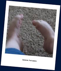This Is What Hurts Me All Day And Keeps Me From Falling Asleep I Feel Beyond Badly For Anyone That Suffers F Parkinsons Parkinsons Disease How To Fall Asleep