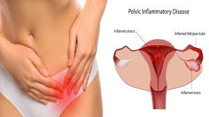 Pin On Health And Wellness Women S Health