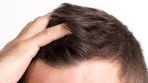 A la actriz siempre le ha gustado cambiar su color y estilo de pelo y con tanta innovación su melena había perdido fuerza y tenía las puntas dañadas y quebradizas por eso ha empezado a. Como Cuidarte El Pelo Si Eres Hombre Trucos Y Consejos
